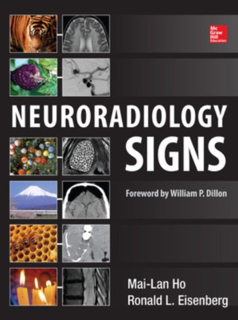 Book cover of: Neuroradiology Signs