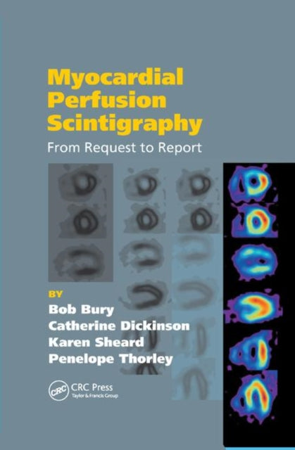 Book cover of: Myocardial Perfusion Scintigraphy. By: R. F. Bury