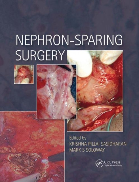 Book cover of: Nephron-Sparing Surgery. By: Krishna Sasidharan