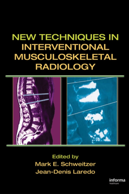 Book cover of: New Techniques in Interventional Musculoskeletal Radiology