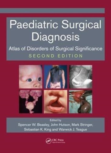 Book cover of: Paediatric Surgical Diagnosis. By: Spencer Beasley