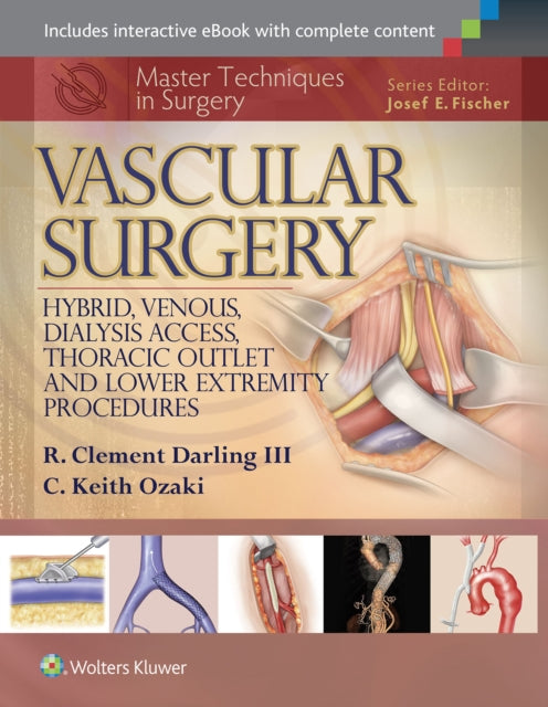 Book cover of: Master Techniques in Surgery: Vascular Surgery: Hybrid, Venous, Dialysis Access, Thoracic Outlet, and Lower Extremity Procedures. By: R. Clement Darling III