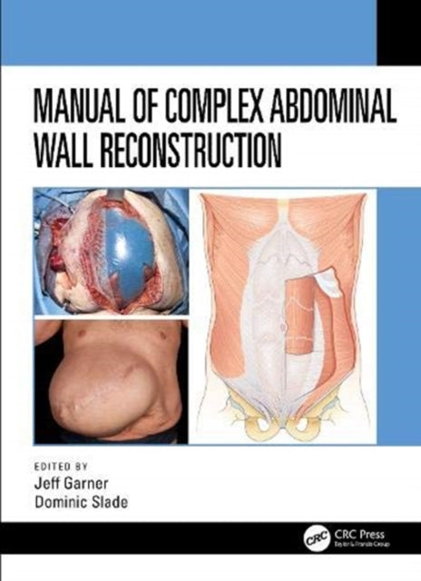 Book cover of: Manual of Complex Abdominal Wall Reconstruction. By: Jeff Garner