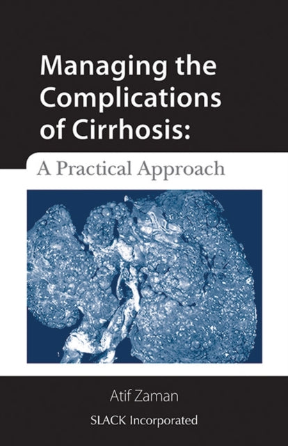 Book cover of: Managing the Complications of Cirrhosis. By: Atif Zaman