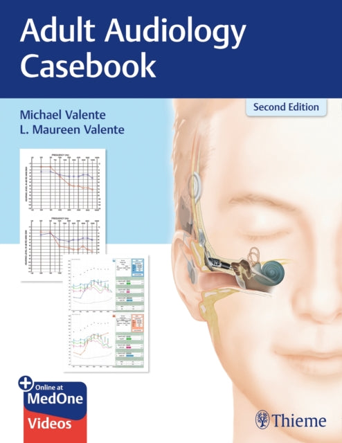 Book cover of: Adult Audiology Casebook. By: Michael Valente