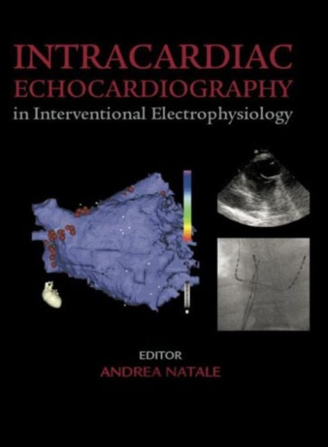 Book cover of: Intracardiac Echocardiography in Interventional Electrophysiology. By: Andrea Natale