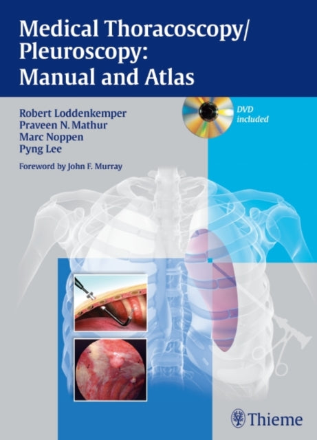 Book cover of: Medical Thoracoscopy / Pleuroscopy: Manual and Atlas. By: Robert Loddenkemper, R. Loddenkemper