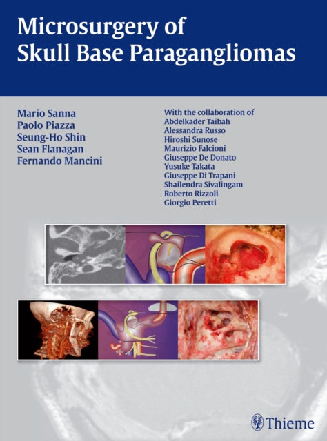 Book cover of: Microsurgery of Skull Base Paragangliomas