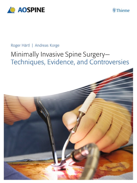 Book cover of: Minimally Invasive Spine Surgery - Techniques, Evidence, and Controversies. By: Roger Haertl
