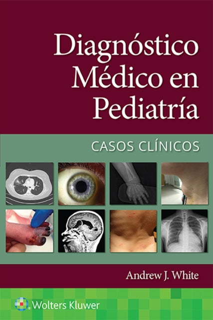 Book cover of: Diagnostico medico en pediatria. Casos clinicos. By: WHITE