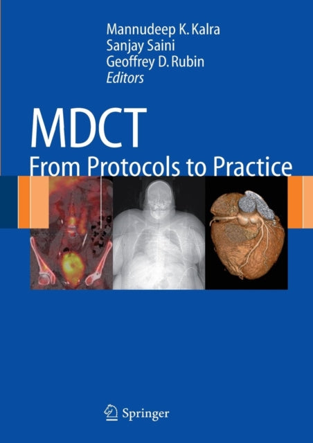 Book cover of: MDCT. By: M. K. Kalra