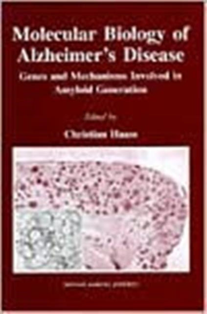 Book cover of: Molecular Biology of Alzheimer's Disease. By: Christian Haass
