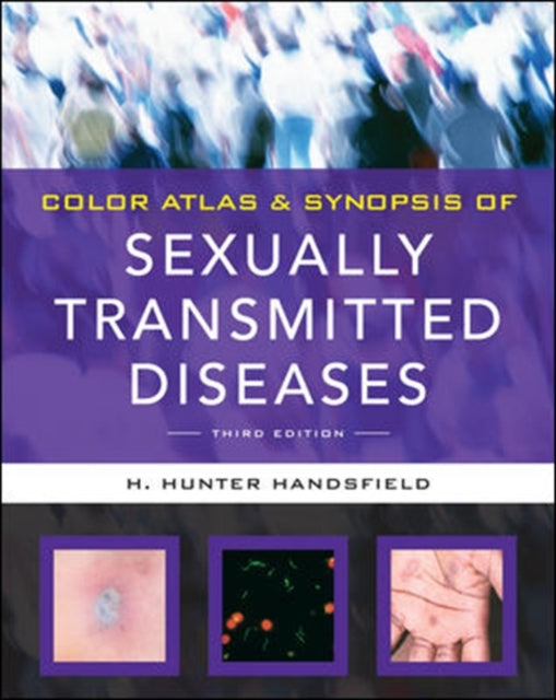 Book cover of: Color Atlas & Synopsis of Sexually Transmitted Diseases, Third Edition. By: H. Hunter Handsfield