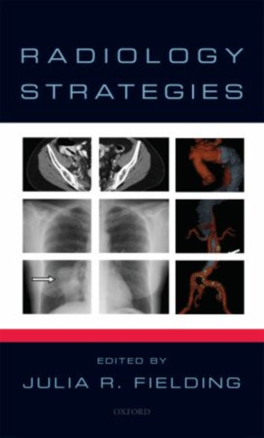 Book cover of: Radiology Strategies