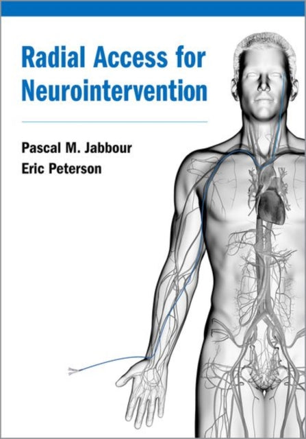 Book cover of: Radial Access for Neurointervention. By: Pascal Jabbour