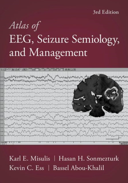 Book cover of: Atlas of EEG, Seizure Semiology, and Management. By: Karl E. Misulis