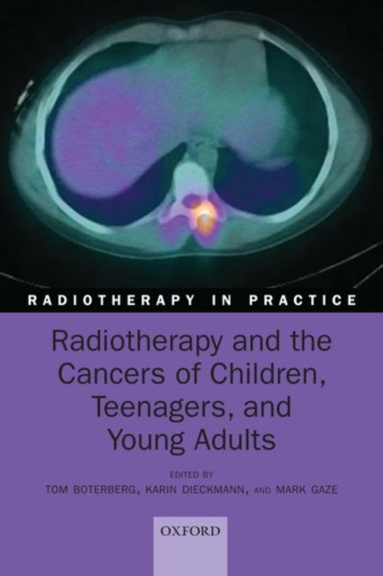 Book cover of: Radiotherapy and the Cancers of Children, Teenagers, and Young Adults. By: Tom Boterberg