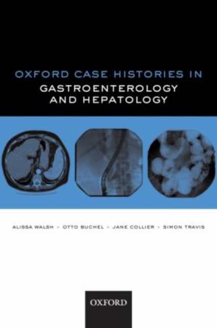 Book cover of: Oxford Case Histories in Gastroenterology and Hepatology. By: Alissa J. Walsh