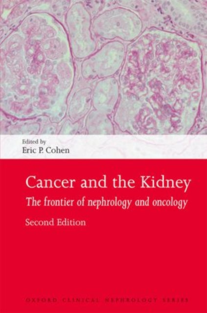 Book cover of: Cancer and the Kidney. By: Eric P. Cohen