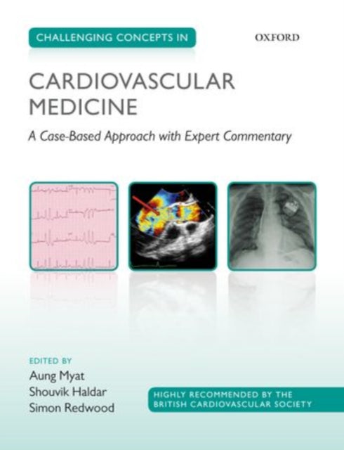 Book cover of: Challenging Concepts in Cardiovascular Medicine. By: Aung Myat
