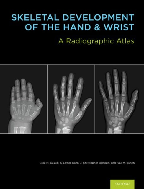 Book cover of: Skeletal Development of the Hand and Wrist. By: Cree M. Gaskin