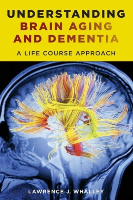 Book cover of: Understanding Brain Aging and Dementia. By: Lawrence J. Whalley