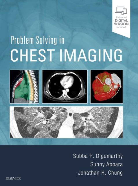 Book cover of: Problem Solving in Chest Imaging. By: Subba R. Digumarthy