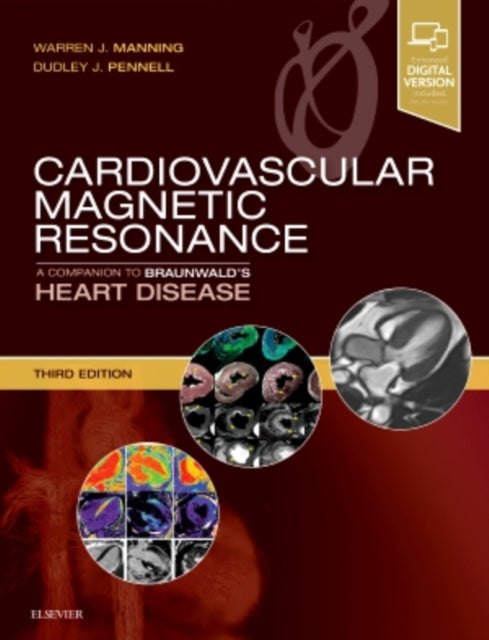 Book cover of: Cardiovascular Magnetic Resonance. By: Warren J. Manning