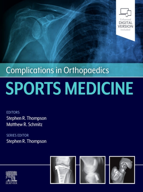 Book cover of: Complications in Orthopaedics: Sports Medicine. By: Stephen R. Thompson