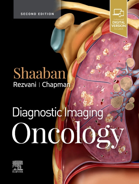 Book cover of: Diagnostic Imaging: Oncology. By: Akram M. Shaaban