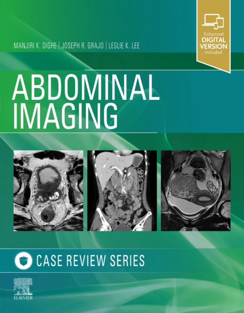 Book cover of: Abdominal Imaging. By: Manjiri Dighe