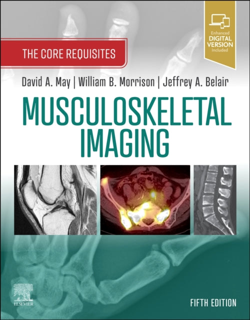 Book cover of: Musculoskeletal Imaging. By: David A. May