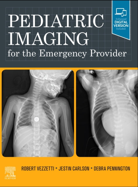 Book cover of: Pediatric Imaging for the Emergency Provider. By: Robert Vezzetti
