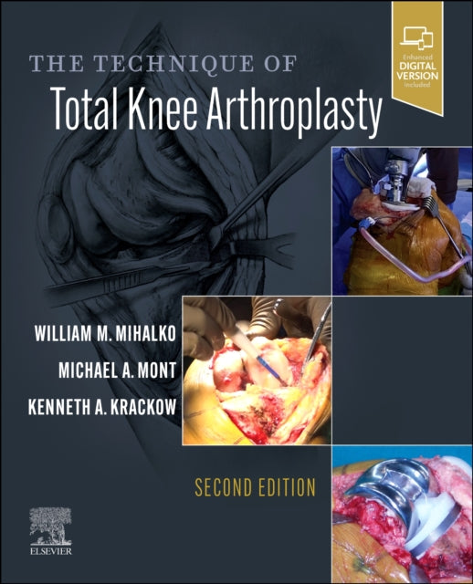 Book cover of: Technique of Total Knee Arthroplasty. By: William M. Mihalko MD  PhD