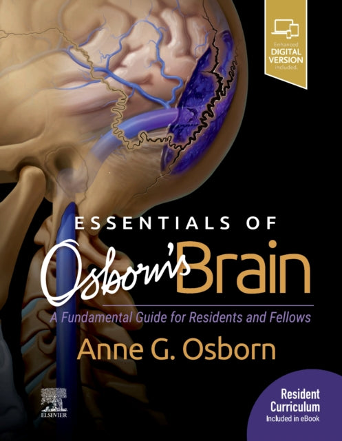 Book cover of: Essentials of Osborn's Brain. By: Anne G. Osborn MD