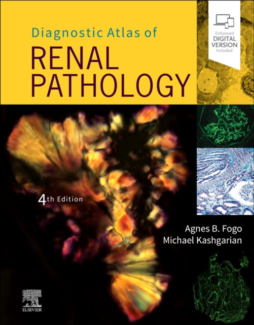 Book cover of: Diagnostic Atlas of Renal Pathology. By: Agnes B. Fogo