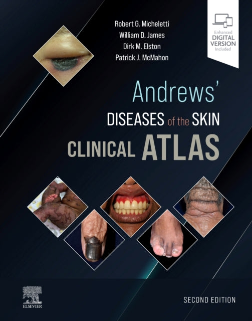 Book cover of: Andrews' Diseases of the Skin Clinical Atlas. By: Robert G. Micheletti