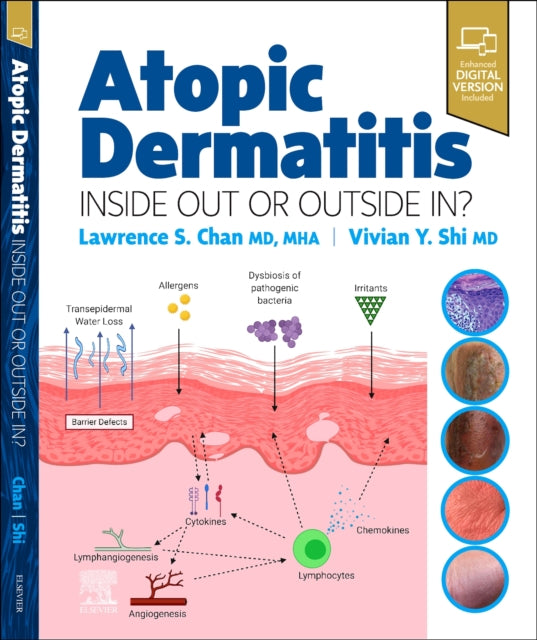 Book cover of: Atopic Dermatitis: Inside Out or Outside In. By: Lawrence S. Chan