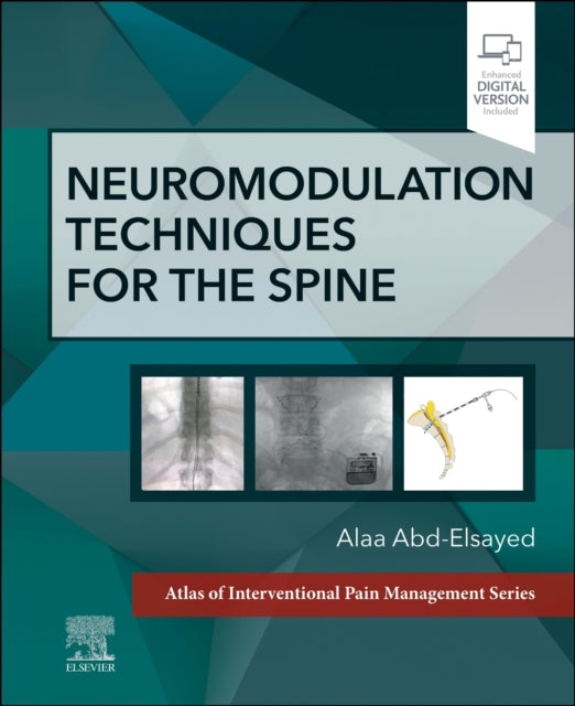 Book cover of: Neuromodulation Techniques for the Spine. By: Alaa Abd-Elsayed