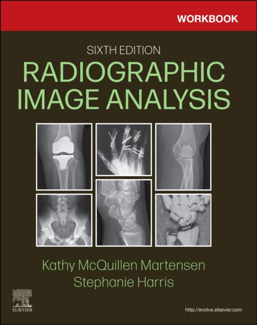 Book cover of: Workbook for Radiographic Image Analysis. By: Kathy McQuillen-Martensen