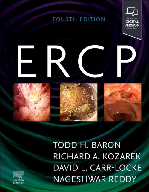 Book cover of: ERCP. By: Todd H. Baron