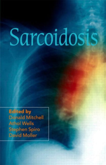 Book cover of: Sarcoidosis. By: D. N. Mitchell