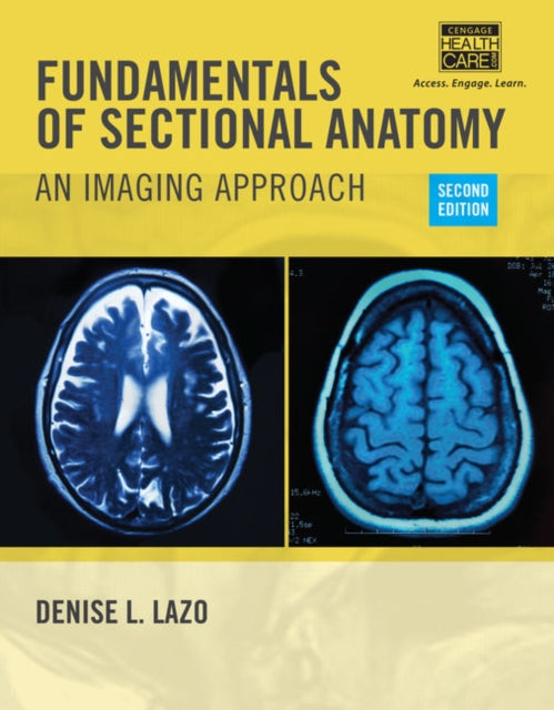 Book cover of: Fundamentals of Sectional Anatomy. By: Denise Lazo