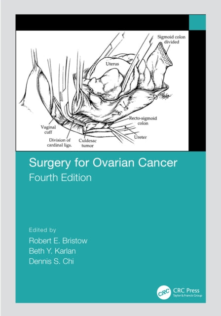 Book cover of: Surgery for Ovarian Cancer. By: Robert Bristow
