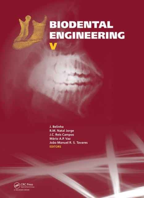 Book cover of: Biodental Engineering V. By: Jorge Belinha