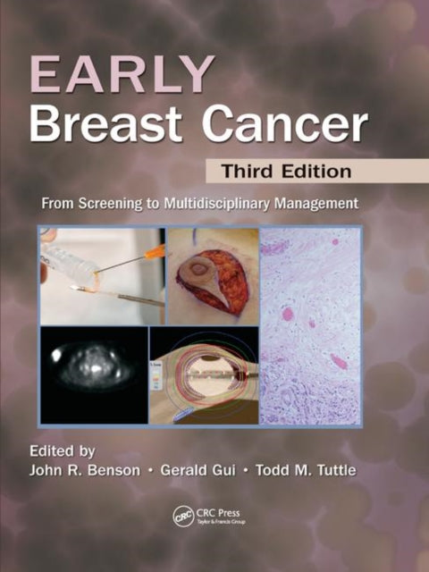 Book cover of: Early Breast Cancer. By: John R. Benson