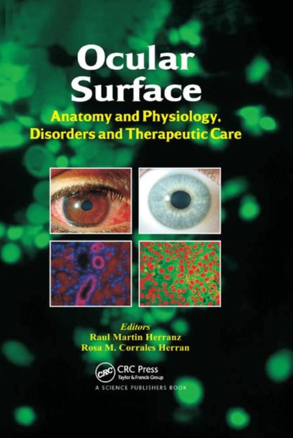 Book cover of: Ocular Surface. By: Raúl Martín Herranz