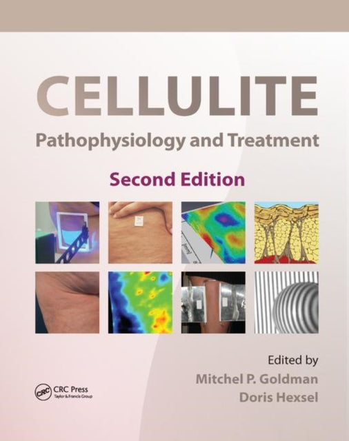Book cover of: Cellulite. By: Mitchel P. Goldman