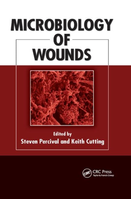 Book cover of: Microbiology of Wounds. By: Steven Percival