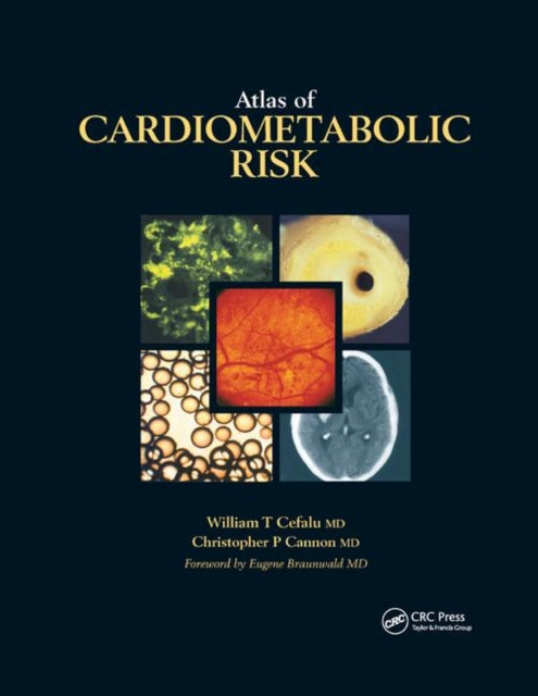 Book cover of: Atlas of Cardiometabolic Risk. By: William T. Cefalu